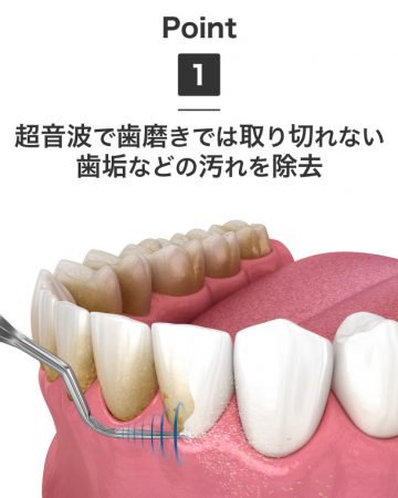 超音波口腔ケアマシン